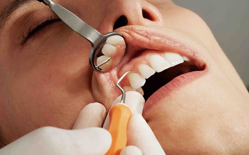 Understanding Different Types Of Cosmetic Dental Procedures