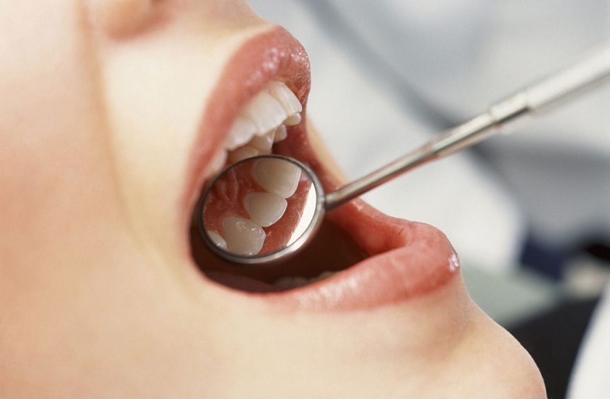 Common Dental Problems Treated By General Dentists