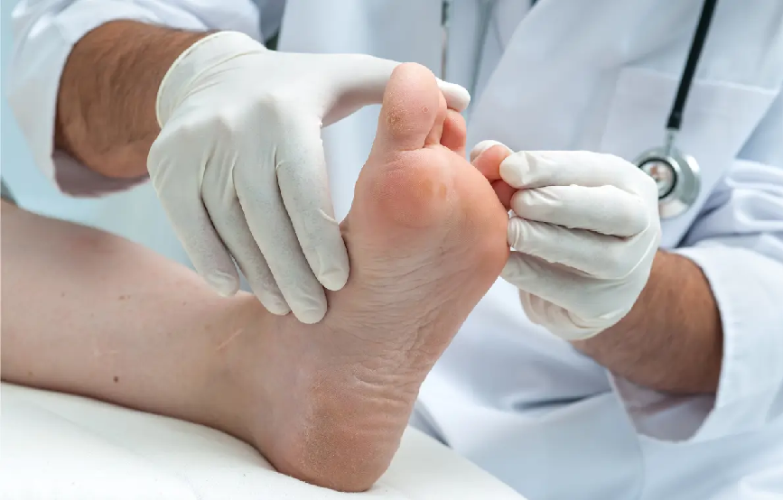 Common Foot Conditions Treated By A Podiatrist