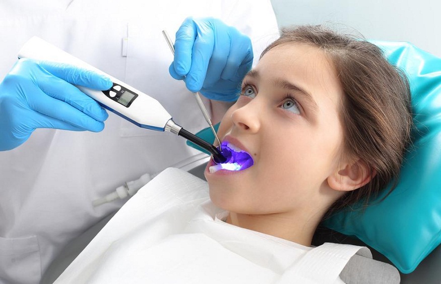 Dental Sealants for Kids and Adults